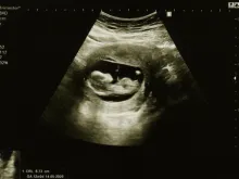 Ultrasound of baby at 12 weeks.